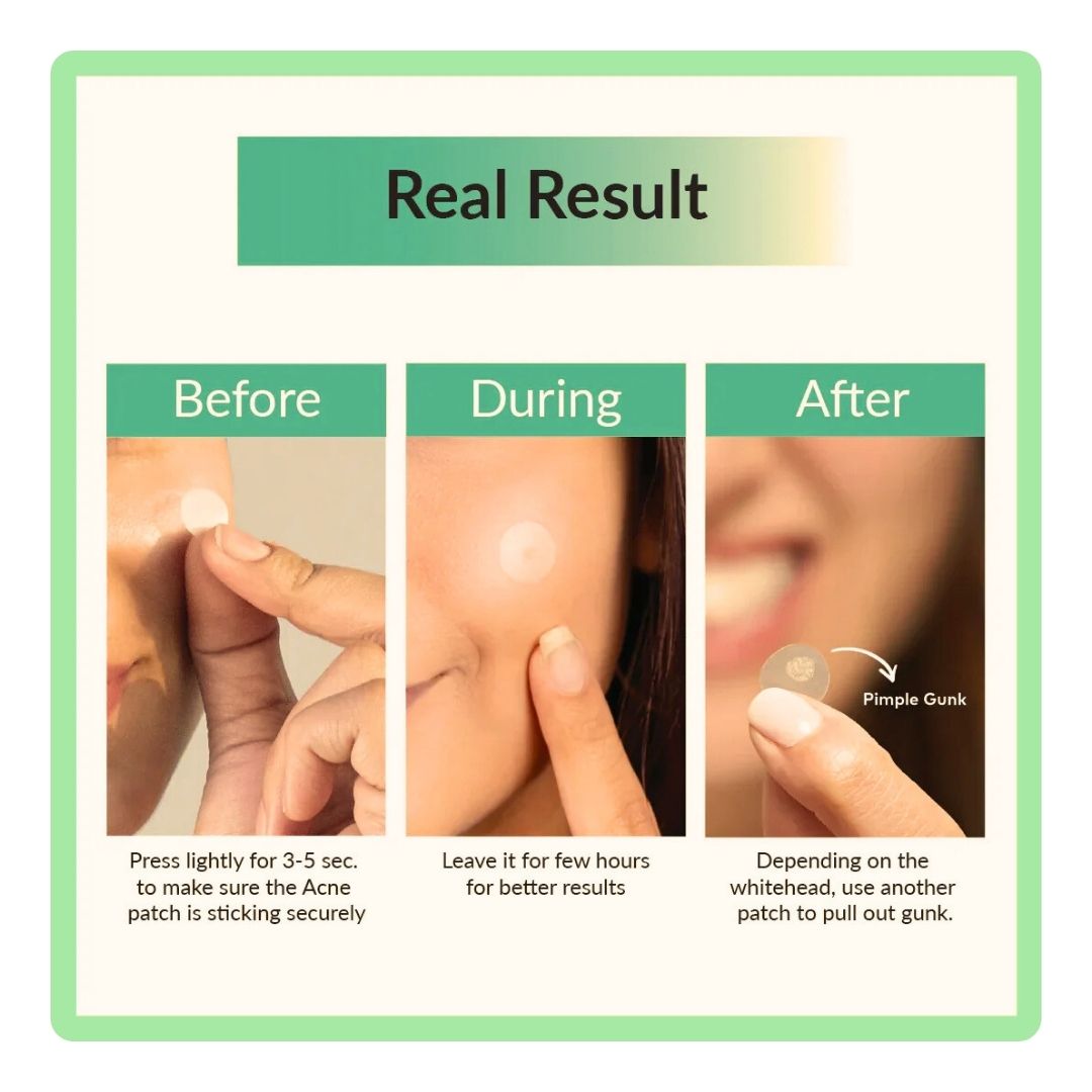 Clear Spot Patch