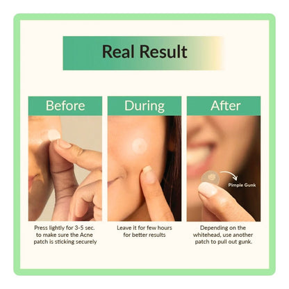 Clear Spot Patch